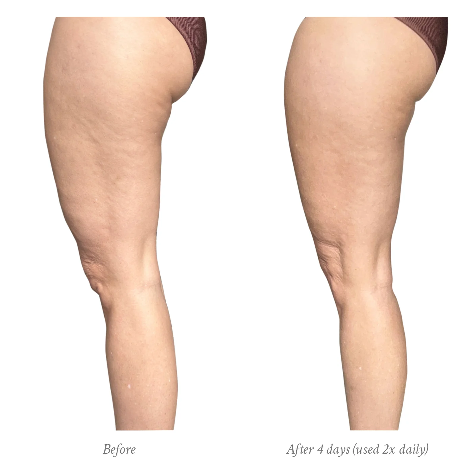 Age-Defying Body Treatment - Image 4