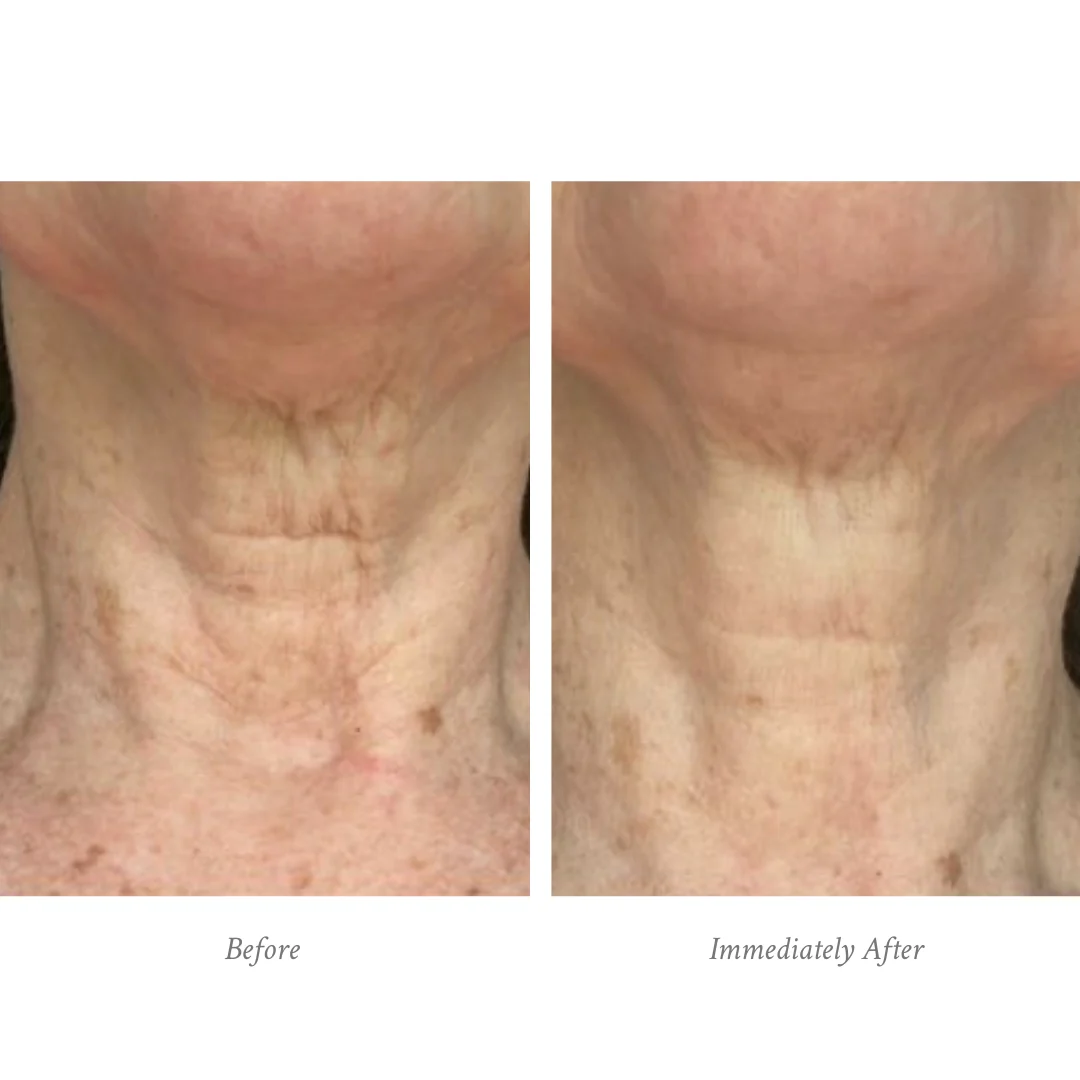 Age-Defying Body Treatment - Image 5