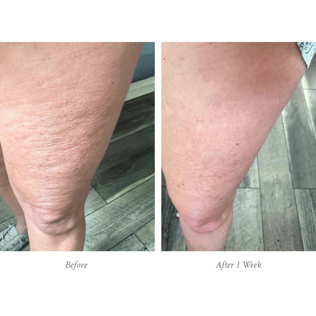 Age-Defying Body Treatment - Image 6